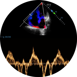 Ultraschall Grundkurs Abdomen